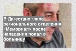 В Дагестане глава регионального отделения «Мемориал» после нападения попал в больницу